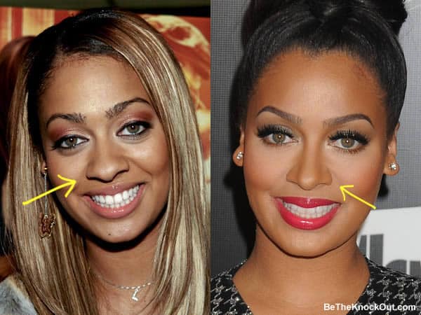 Has Lala Anthony had a nose job?