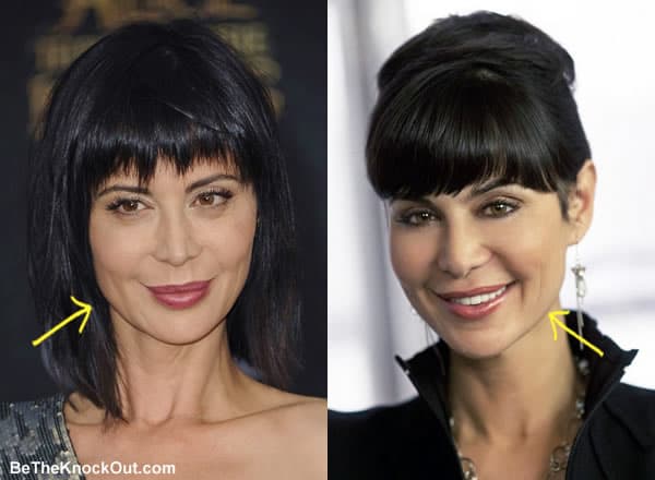 Has Catherine Bell had a facelift?