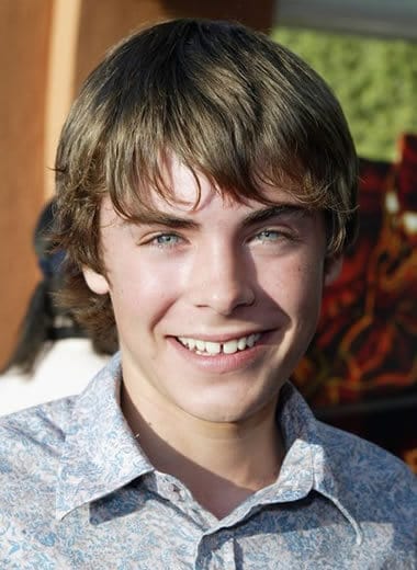 Zac Efron had flaws on his front tooth