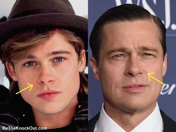 Has Brad Pitt had a nose job?