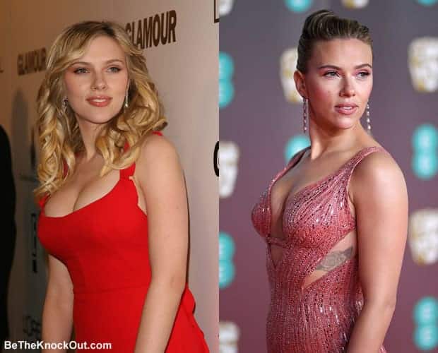 Did Scarlett Johansson get a breast reduction?
