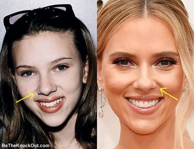 Has Scarlett Johansson had a nose job?