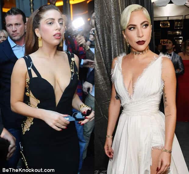 Lady Gaga boob job before and after comparison photo
