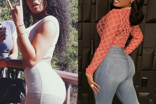 Has Megan Thee Stallion have a butt lift?