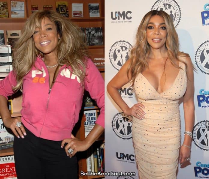 Wendy Williams breast implants before and after comparison photo.