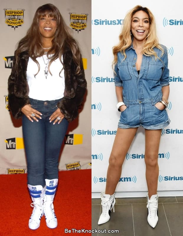 Wendy Williams liposuction before and after comparison photo