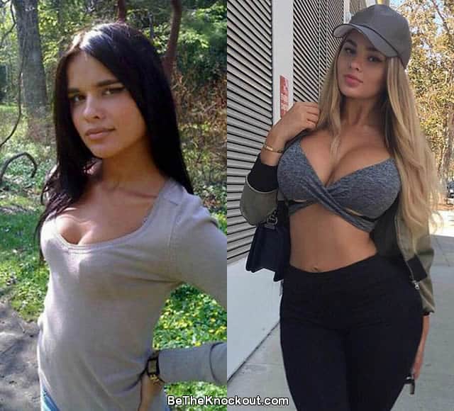 Anastasia Kvitko boob job before and after photo comparison