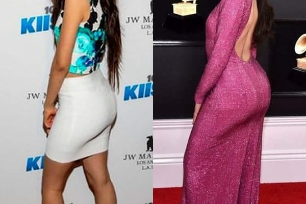 Camila Cabello butt lift before and after comparison photo