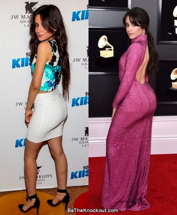 Camila Cabello butt lift before and after comparison photo