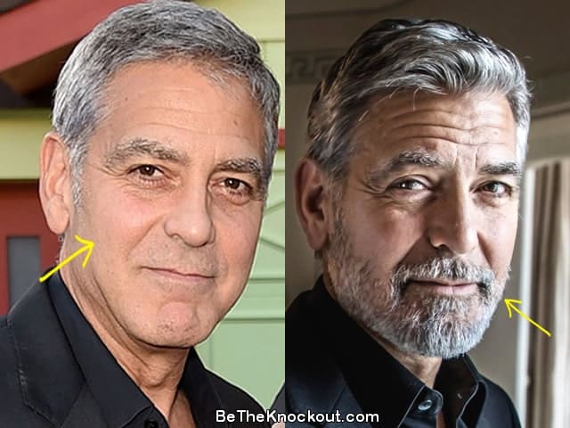 George Clooney facelift before and after photo comparison