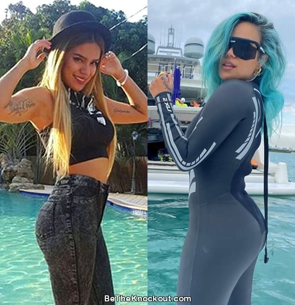 Karol G butt lift before and after comparison photo