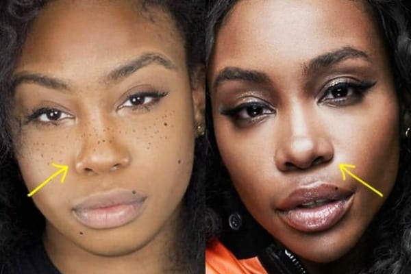SZA nose job before and after comparison photo