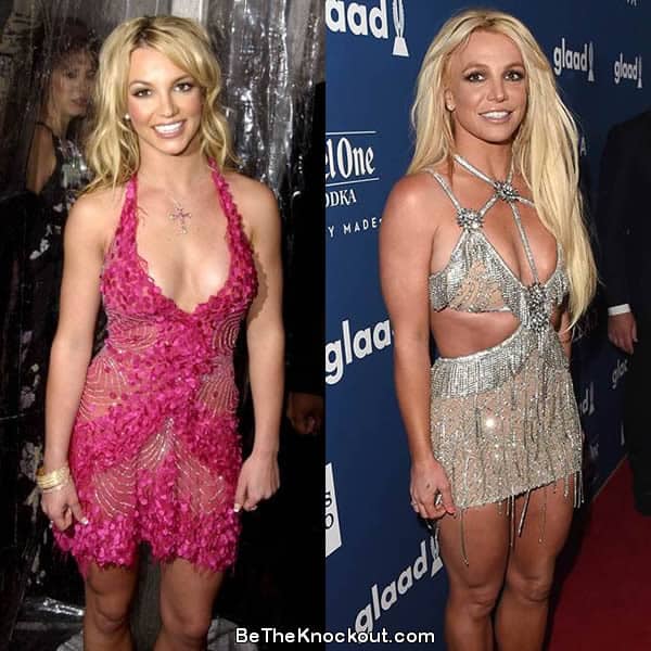 Britney Spears boob job before and after photo comparison