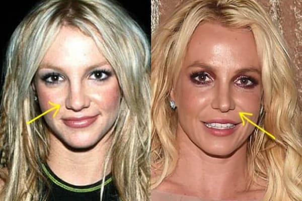 Britney Spears nose job before and after photo comparison