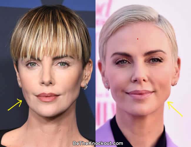 Charlize Theron face lift before and after photo comparison