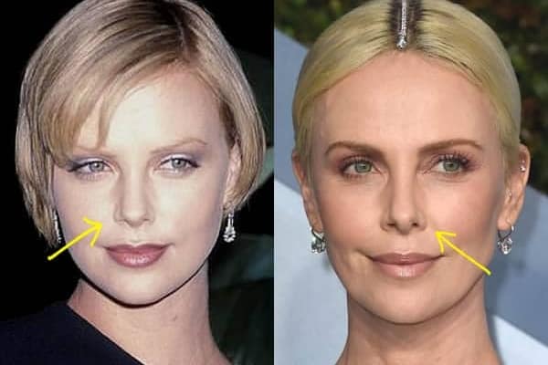 Charlize Theron nose job before and after photo comparison comparison photo