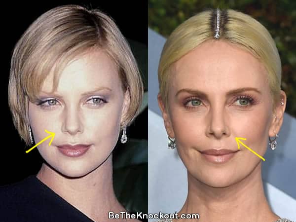 Charlize Theron nose job before and after photo comparison comparison photo