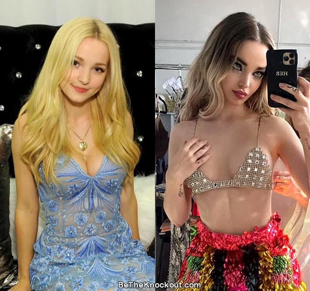 Dove Cameron boob job before and after photo comparison
