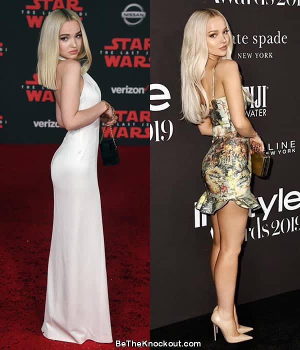 Dove Cameron butt lift before and after photo comparison