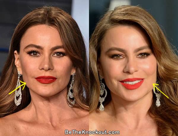 Sofia Vergara facelift before and after photo comparison