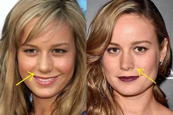 Brie Larson nose job before and after comparison photo