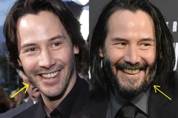 Keanu Reeves botox before and after comparison photo