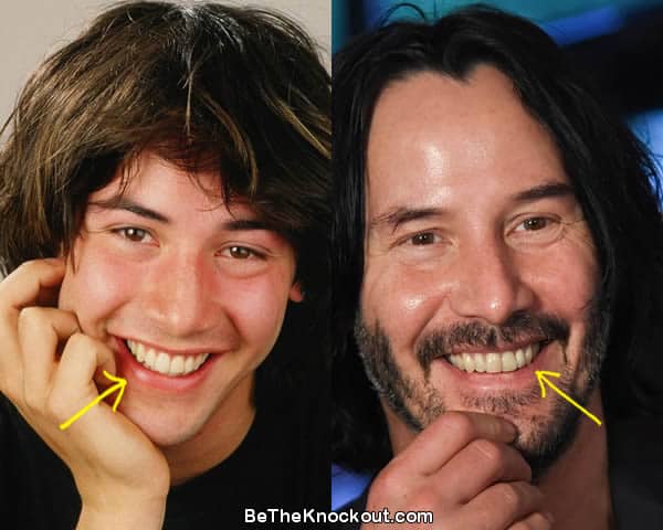 Keanu Reeves teeth before and after comparison photo