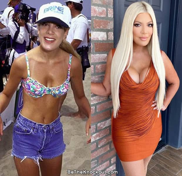 Tori Spelling boob job before and after comparison photo