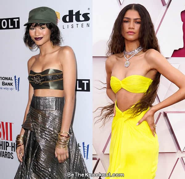 Zendaya boob job before and after comparison photo