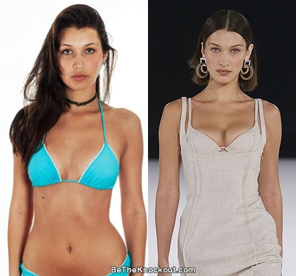 Bella Hadid boob job before and after comparison photo