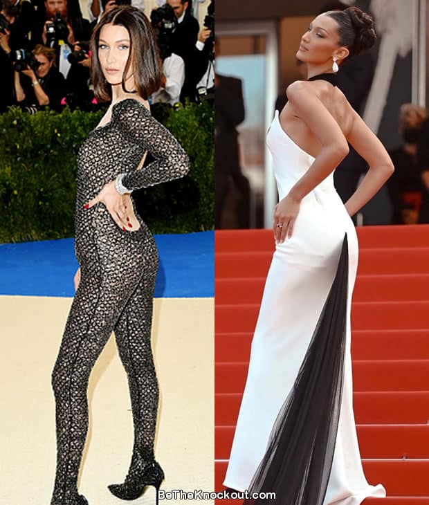 Bella Hadid butt lift before and after comparison photo