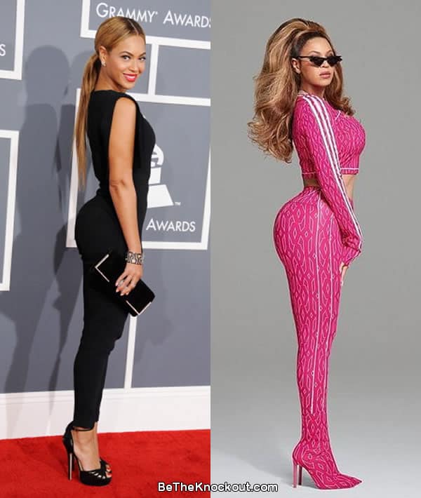 Beyonce butt lift before and after comparison photo