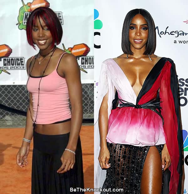 Kelly Rowland boob job before and after comparison photo