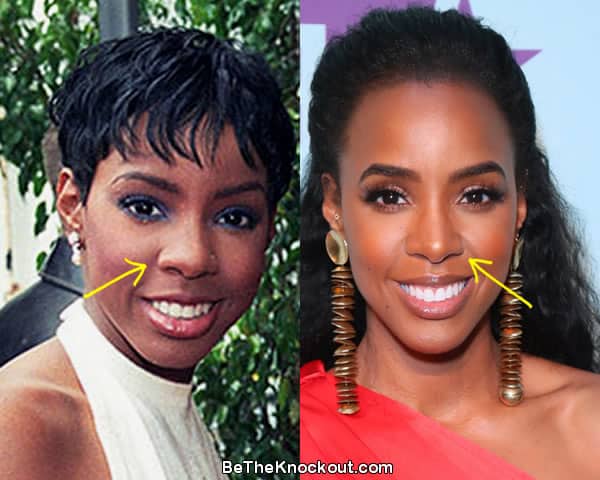 Kelly Rowland nose job before and after comparison photo