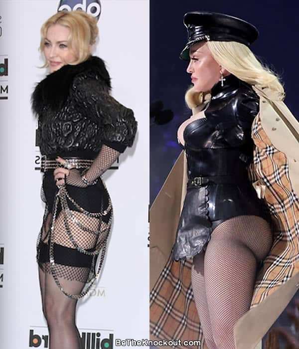 Madonna butt implants before and after comparison photos