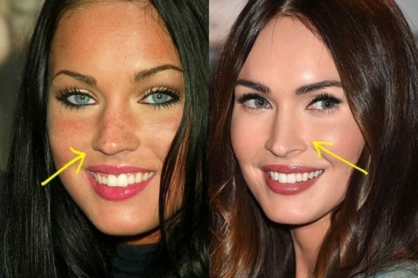 Megan Fox nose job before and after comparison photo