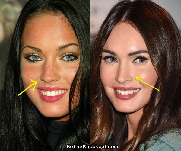 Megan Fox nose job before and after comparison photo