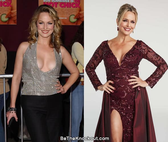 Melora Hardin boob job before and after comparison photo