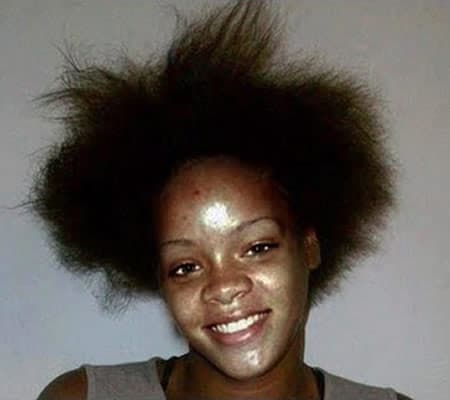 Rihanna with crazy hair and oily face