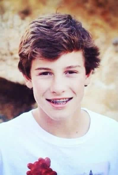Shawn Mendes getting braces