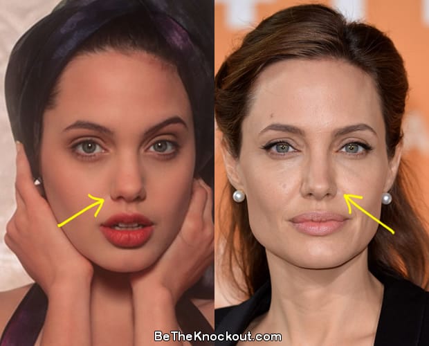 Angelina Jolie nose job before and after comparison photo