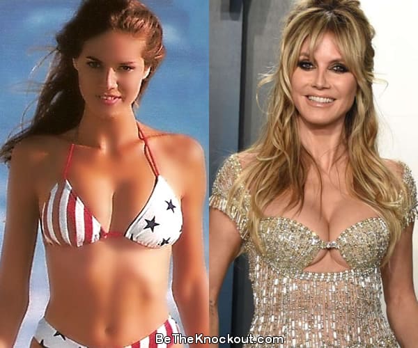 Heidi Klum boob job before and after comparison photo