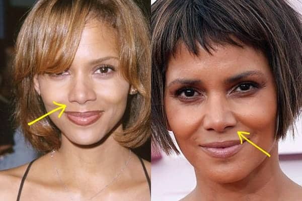 Halle Berry nose job before and after comparison photo