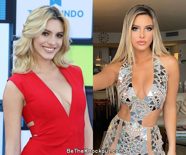 Lele Pons boob job before and after comparison photo