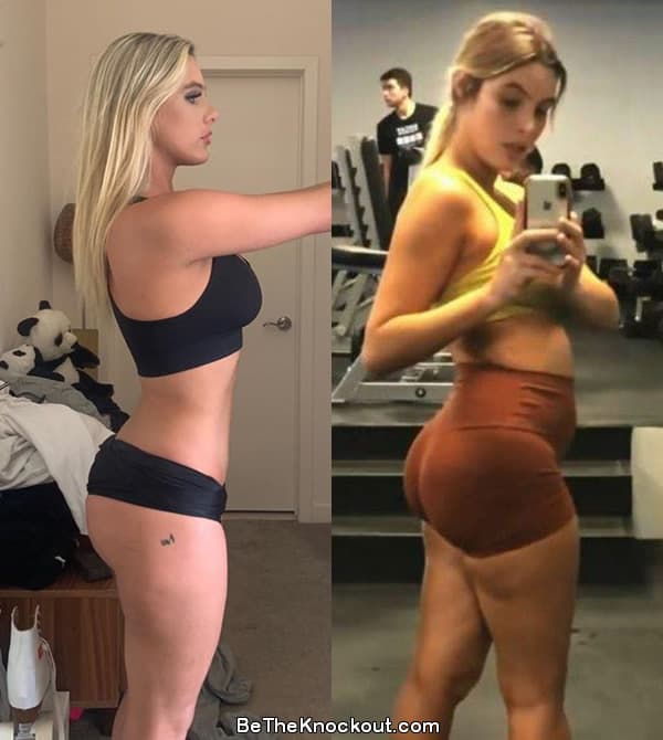 Lele Pons butt lift before and after comparison photo