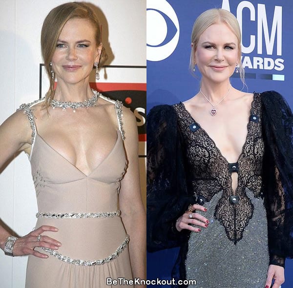 Nicole Kidman breast implants before and after comparison photo