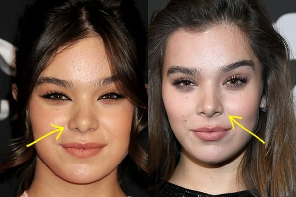 Hailee Steinfeld nose job before and after comparison photo