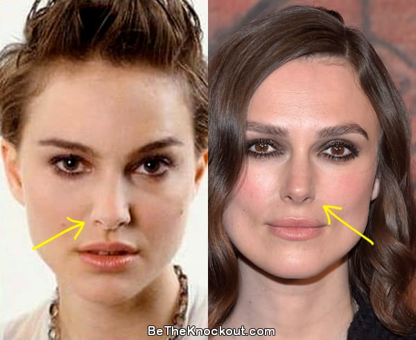 Keira Knightley nose job before and after comparison photo