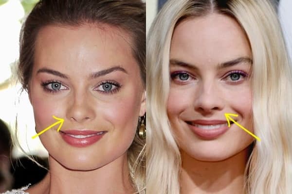 Margot Robbie nose job before and after comparison photo