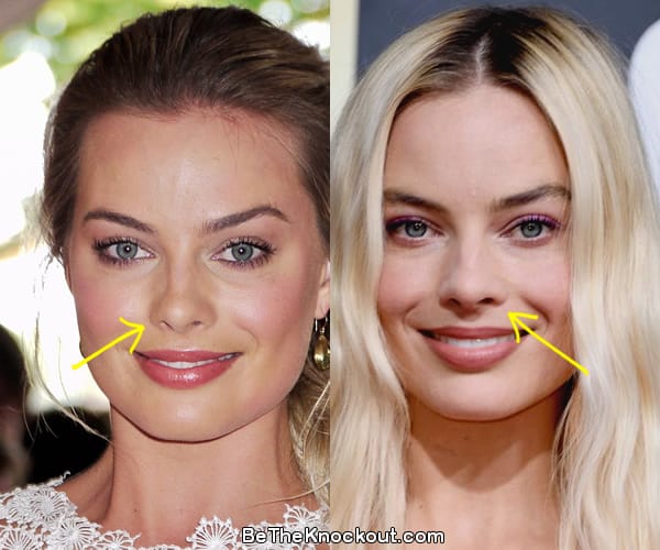 Margot Robbie nose job before and after comparison photo
